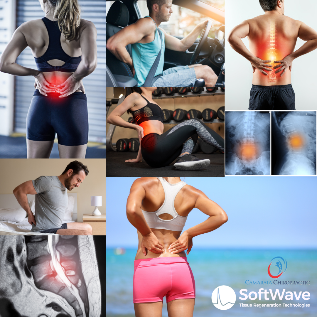 Healing Without Surgery: SoftWave Therapy for Common Orthopedic Conditions in Rochester, NY