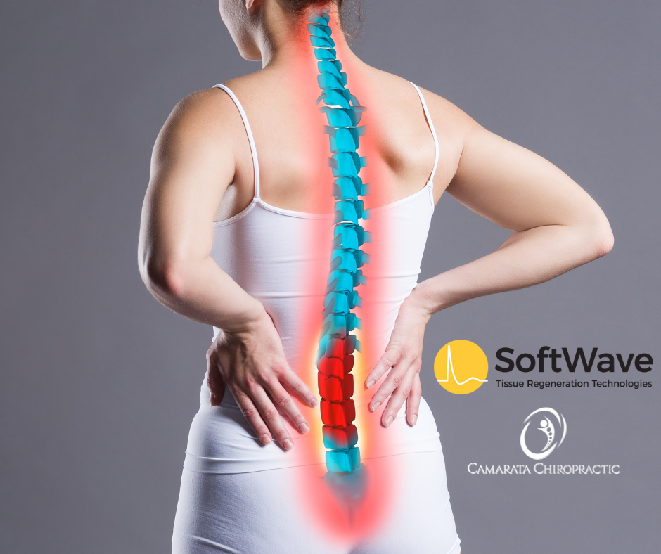 Advanced Sciatica Pain Relief: The SoftWave Therapy Solution at Camarata Chiropractic & Wellness