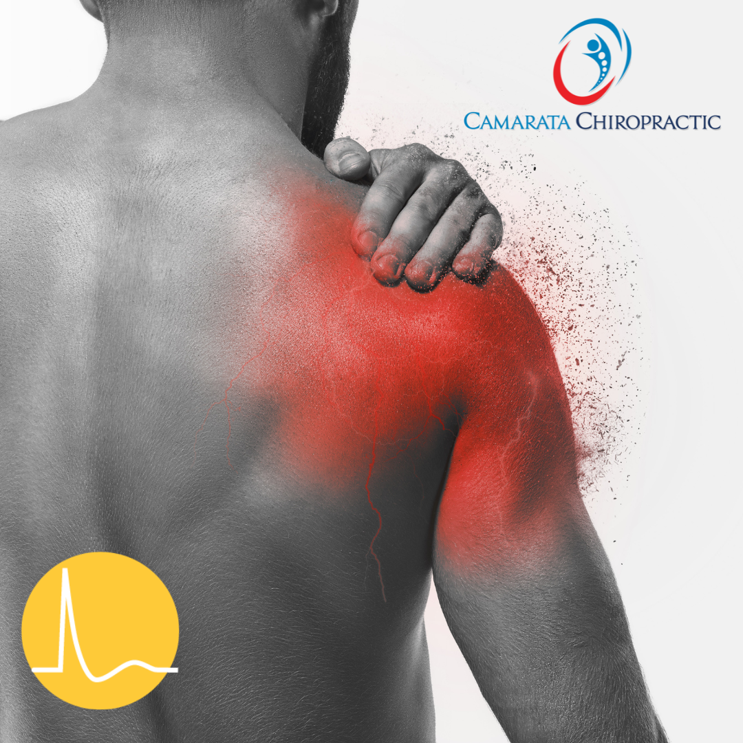 Rotator Cuff Tears and SoftWave Therapy: A Non-Surgical Solution in Rochester, NY